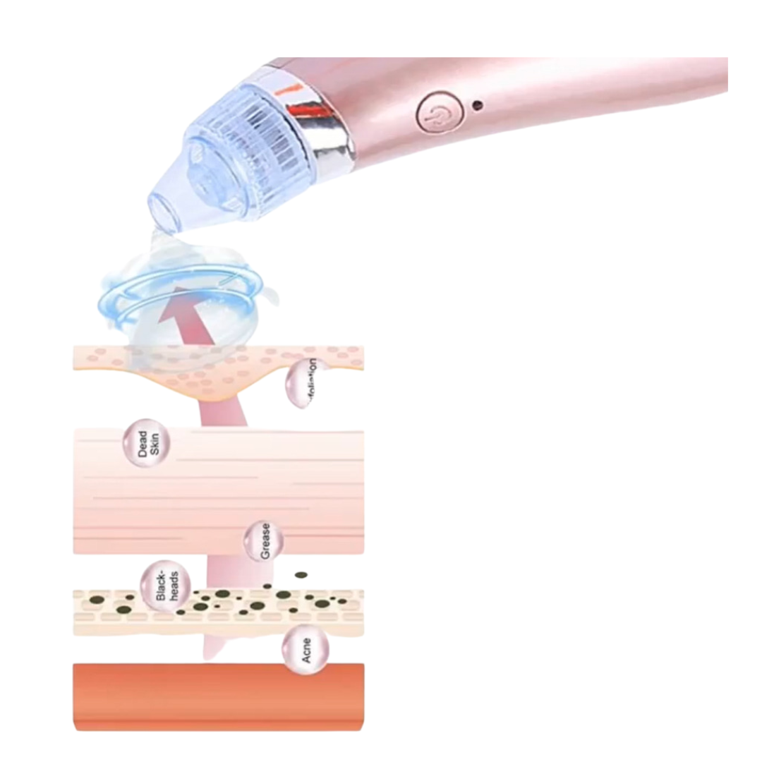 Diamond Skin Peeling Pore Cleaner